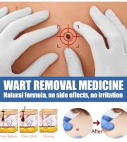 Wart Removal Cream